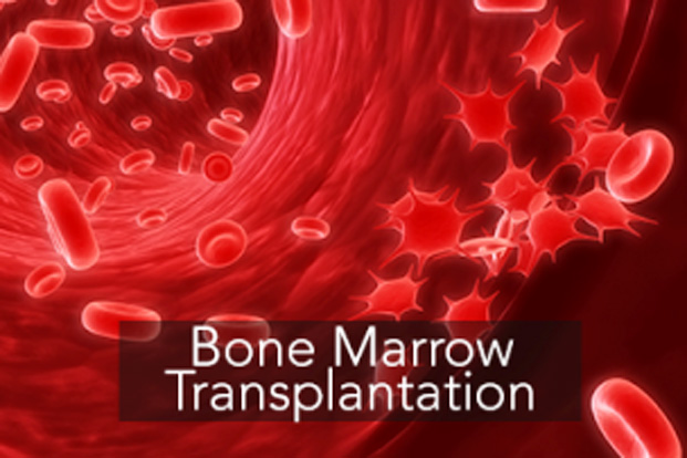 Bone Marrow Transplant and It’s Costs