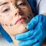 Things To Consider Before Going For A Plastic Surgery