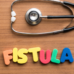 How Long Does It Take To Heal From A Laser Fistula Surgery?