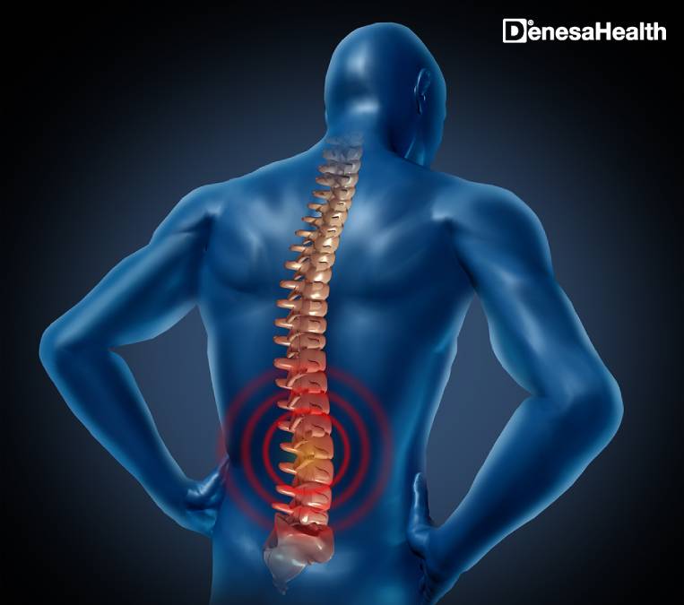 At What Cost Is It Possible to Avail Lumbar Decompression Treatment in India?